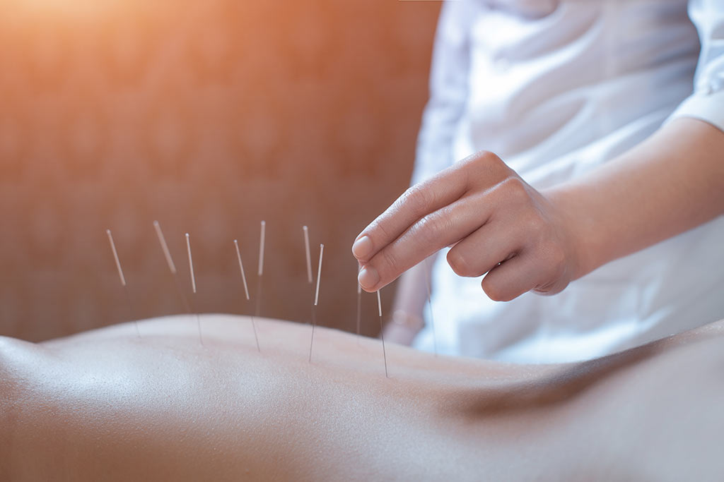 acupunture-service